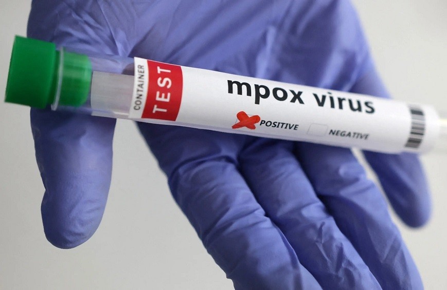 Sobe para 140 número de casos confirmados de Mpox no Brasil, em 2026