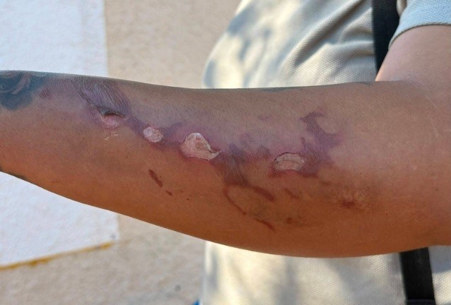 “Vi meus filhos em chamas”, diz mãe após explosão que matou criança de 3 anos