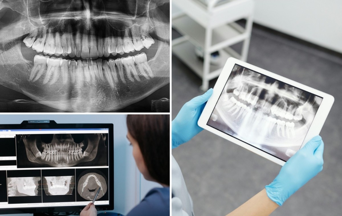 Prefeitura de Naviraí recebe novo RX panorâmico para a Odontologia Municipal 