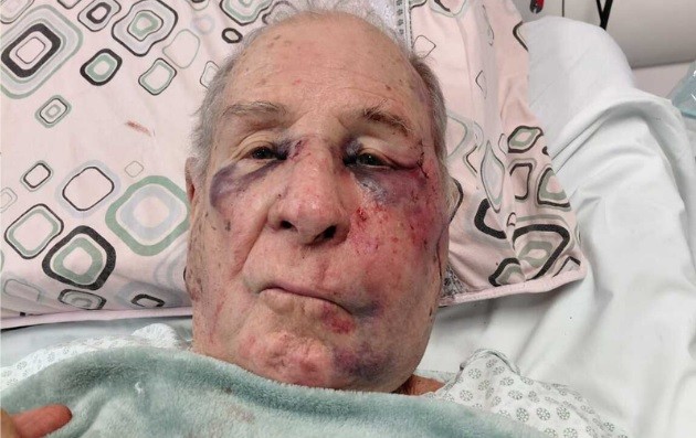 Com agressor solto, família pede justiça pela morte de idoso espancado em casa